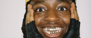 Eine lächelnde Person mit goldenen Grills zeigt ihre Zähne. Sie trägt Handschuhe und einen gelben Hut, die Hände an den Wangen.